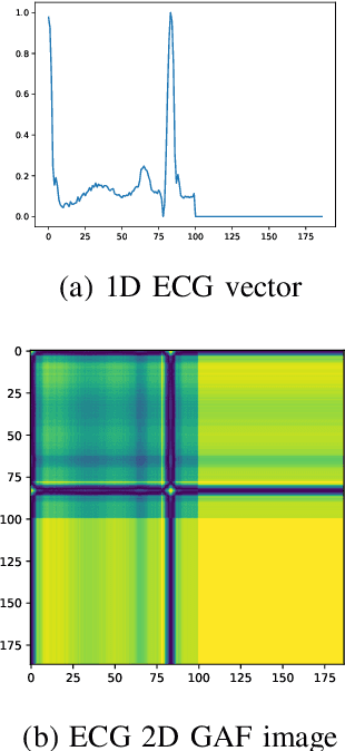 Figure 2 for ECG classification using Deep CNN and Gramian Angular Field