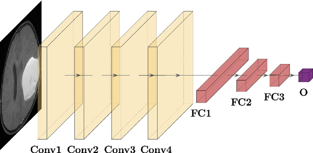 Figure 3 for Deep neuroevolution for limited, heterogeneous data: proof-of-concept application to Neuroblastoma brain metastasis using a small virtual pooled image collection