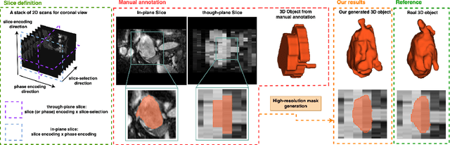 Figure 1 for SuperMask: Generating High-resolution object masks from multi-view, unaligned low-resolution MRIs