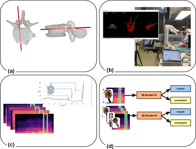 Figure 1 for Automatic breach detection during spine pedicle drilling based on vibroacoustic sensing