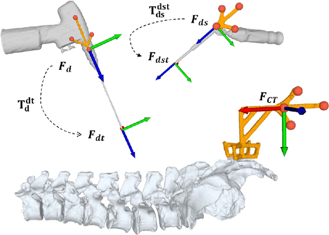 Figure 4 for Automatic breach detection during spine pedicle drilling based on vibroacoustic sensing