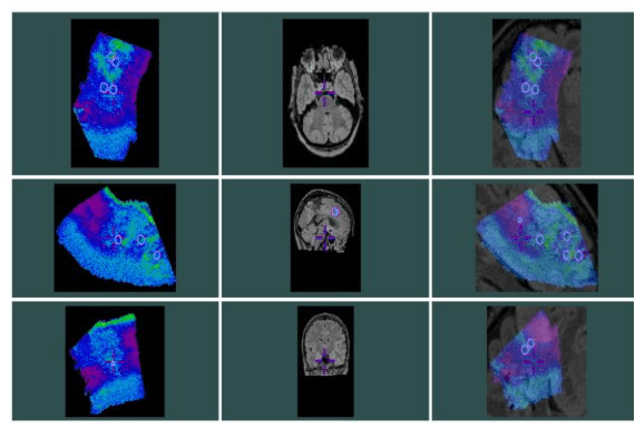 Figure 4 for BrainVoxGen: Deep learning framework for synthesis of Ultrasound to MRI