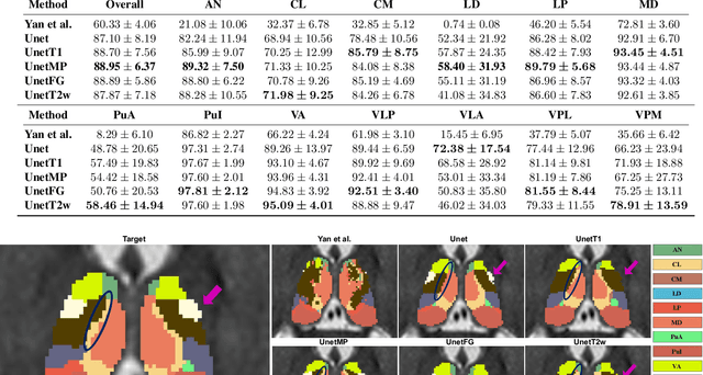 Figure 2 for Label Propagation via Random Walk for Training Robust Thalamus Nuclei Parcellation Model from Noisy Annotations