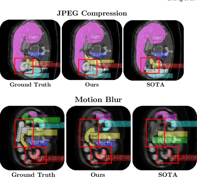 Figure 3 for Sensitivity-Informed Augmentation for Robust Segmentation