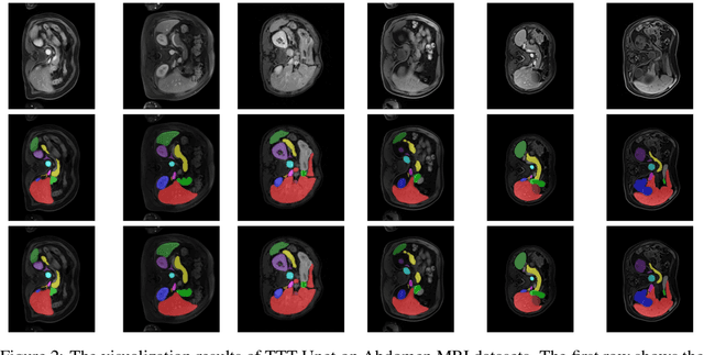 Figure 4 for TTT-Unet: Enhancing U-Net with Test-Time Training Layers for Biomedical Image Segmentation