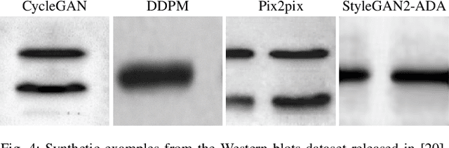 Figure 4 for Localization of Synthetic Manipulations in Western Blot Images