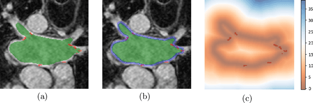 Figure 3 for Automatically Segment the Left Atrium and Scars from LGE-MRIs Using a Boundary-focused nnU-Net