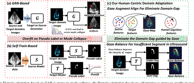 Figure 1 for Gaze-Assisted Human-Centric Domain Adaptation for Cardiac Ultrasound Image Segmentation