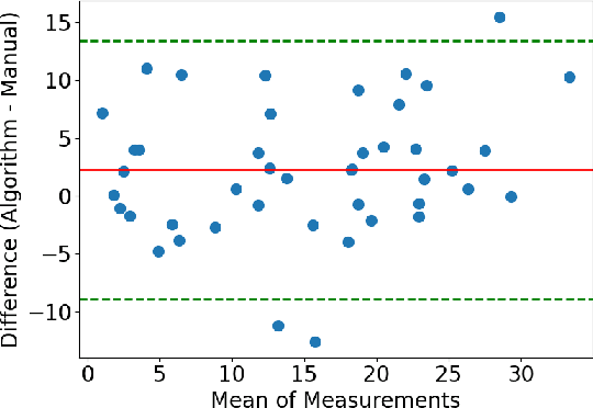 Figure 3 for Pose State Perception of Interventional Robot for Cardio-cerebrovascular Procedures