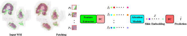 Figure 1 for Multi-head Attention-based Deep Multiple Instance Learning