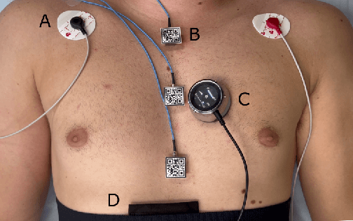 Figure 1 for Effect of Measurement Location on Cardiac Time Intervals Estimated by Seismocardiography