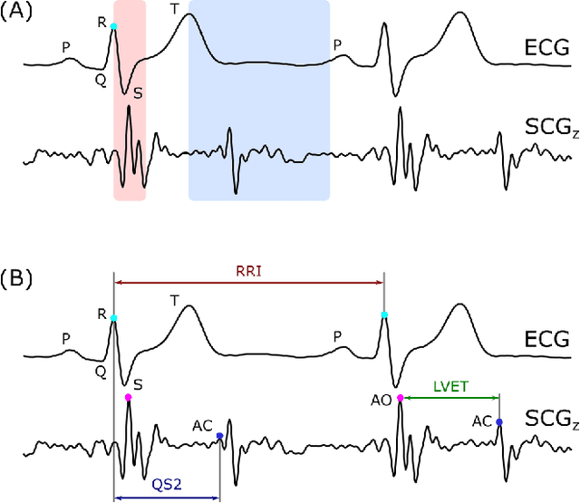 Figure 3 for Effect of Measurement Location on Cardiac Time Intervals Estimated by Seismocardiography