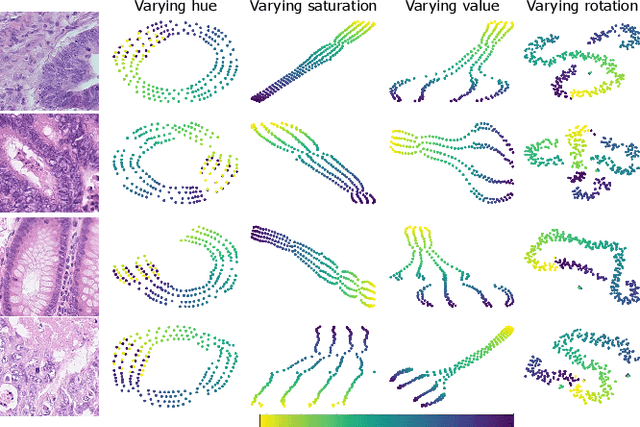 Figure 1 for Embedding Space Augmentation for Weakly Supervised Learning in Whole-Slide Images