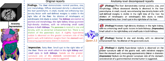 Figure 3 for Large-scale and Fine-grained Vision-language Pre-training for Enhanced CT Image Understanding