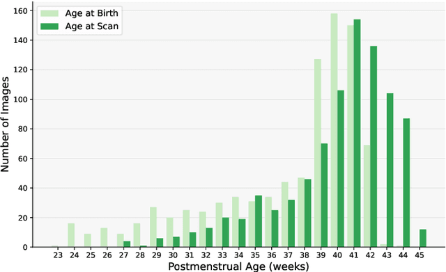 Figure 1 for The Developing Human Connectome Project: A Fast Deep Learning-based Pipeline for Neonatal Cortical Surface Reconstruction