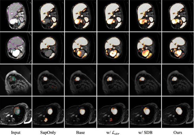 Figure 4 for Style-Aware Blending and Prototype-Based Cross-Contrast Consistency for Semi-Supervised Medical Image Segmentation