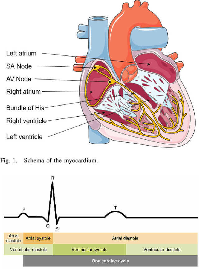 Figure 1 for Monitoring of the heart movements using a FMCW radar and correlation with an ECG