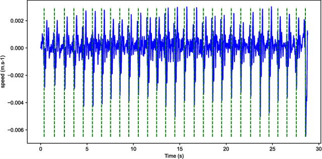 Figure 4 for Monitoring of the heart movements using a FMCW radar and correlation with an ECG