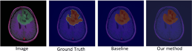 Figure 2 for Enhancing Brain Tumor Segmentation Using Channel Attention and Transfer learning