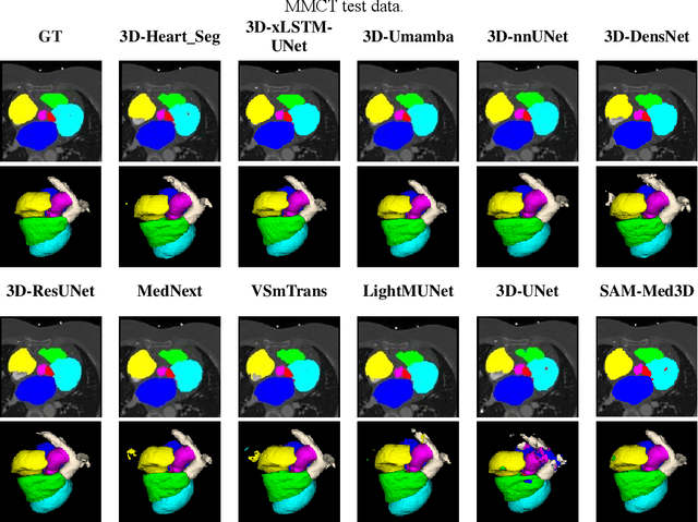 Figure 4 for Foundation Model for Whole-Heart Segmentation: Leveraging Student-Teacher Learning in Multi-Modal Medical Imaging