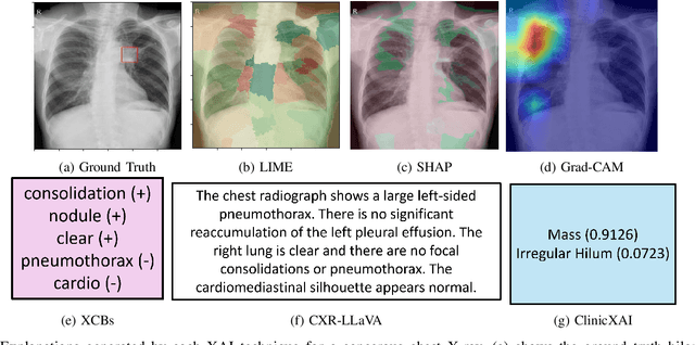 Figure 3 for Transparent and Clinically Interpretable AI for Lung Cancer Detection in Chest X-Rays