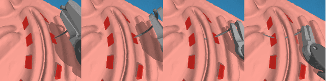 Figure 3 for Safe Uncertainty-Aware Learning of Robotic Suturing