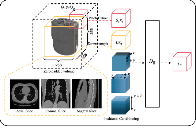 Figure 1 for Local Patches Meet Global Context: Scalable 3D Diffusion Priors for Computed Tomography Reconstruction