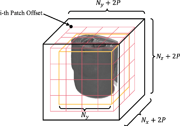 Figure 2 for Local Patches Meet Global Context: Scalable 3D Diffusion Priors for Computed Tomography Reconstruction