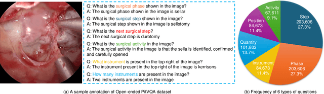 Figure 2 for PitVQA++: Vector Matrix-Low-Rank Adaptation for Open-Ended Visual Question Answering in Pituitary Surgery