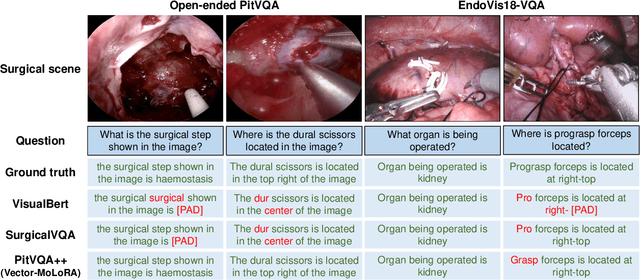 Figure 4 for PitVQA++: Vector Matrix-Low-Rank Adaptation for Open-Ended Visual Question Answering in Pituitary Surgery