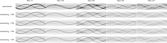 Figure 3 for Learned denoising with simulated and experimental low-dose CT data