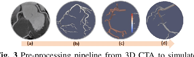 Figure 3 for AI-based Agents for Automated Robotic Endovascular Guidewire Manipulation