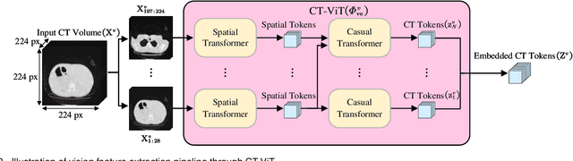 Figure 4 for MvKeTR: Chest CT Report Generation with Multi-View Perception and Knowledge Enhancement
