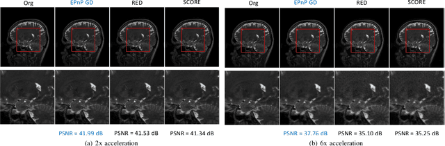 Figure 2 for Plug-and-Play Deep Energy Model for Inverse problems