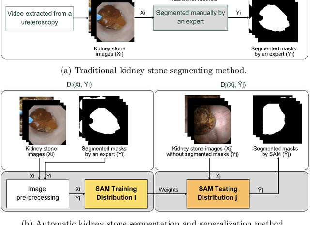 Figure 1 for Assessing the generalization performance of SAM for ureteroscopy scene understanding