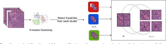 Figure 3 for Finding Regions of Interest in Whole Slide Images Using Multiple Instance Learning