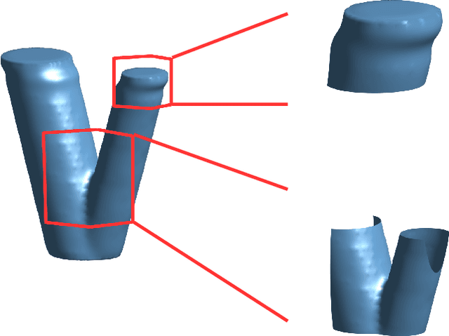 Figure 3 for Super-Resolution Surface Reconstruction from Few Low-Resolution Slices