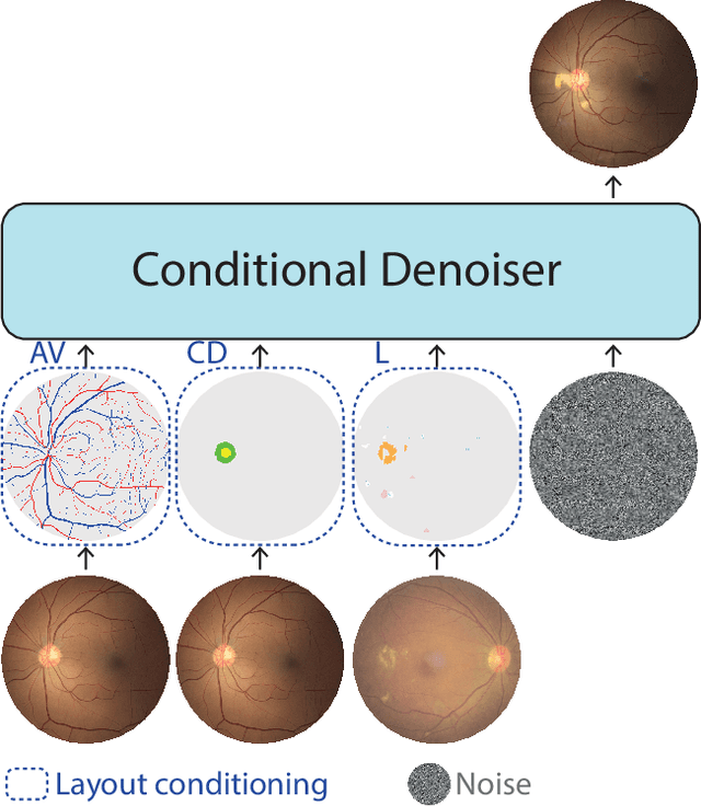 Figure 1 for Enhancing Retinal Vessel Segmentation Generalization via Layout-Aware Generative Modelling