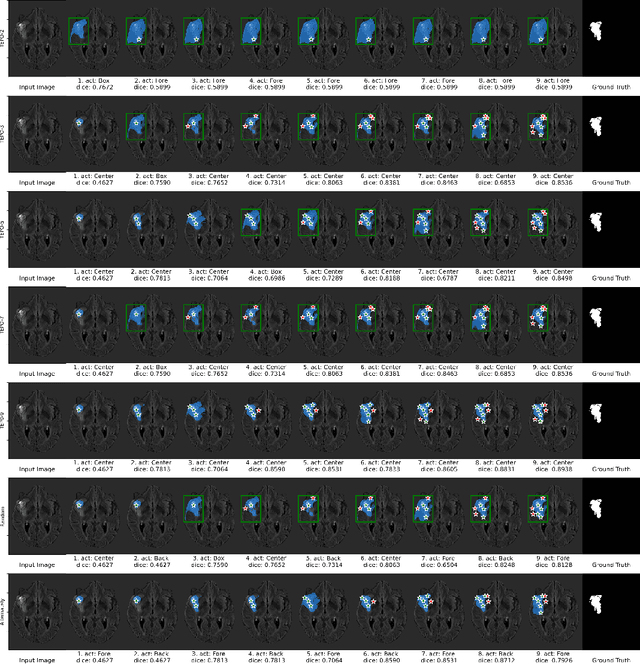 Figure 4 for Temporally-Extended Prompts Optimization for SAM in Interactive Medical Image Segmentation