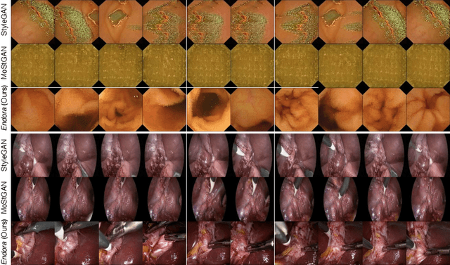 Figure 4 for Endora: Video Generation Models as Endoscopy Simulators
