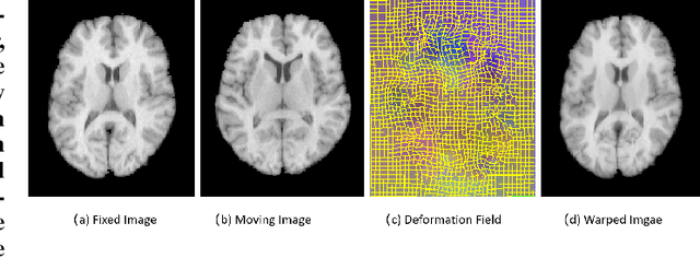 Figure 1 for FF-PNet: A Pyramid Network Based on Feature and Field for Brain Image Registration