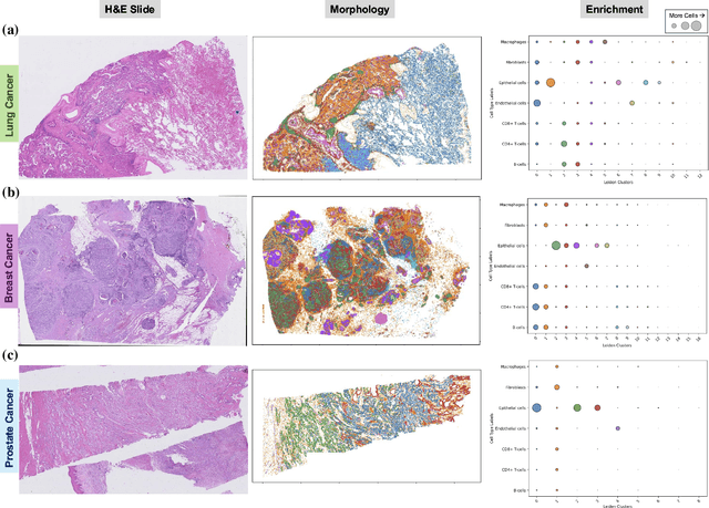Figure 4 for CellSymphony: Deciphering the molecular and phenotypic orchestration of cells with single-cell pathomics
