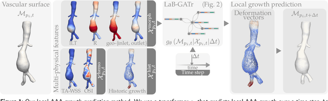 Figure 1 for Geometric deep learning for local growth prediction on abdominal aortic aneurysm surfaces
