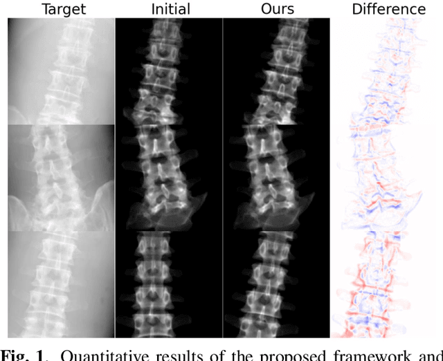 Figure 2 for Introducing Learning Rate Adaptation CMA-ES into Rigid 2D/3D Registration for Robotic Navigation in Spine Surgery