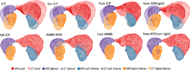 Figure 3 for Semantic-ICP: Iterative Closest Point for Non-rigid Multi-Organ Point Cloud Registration