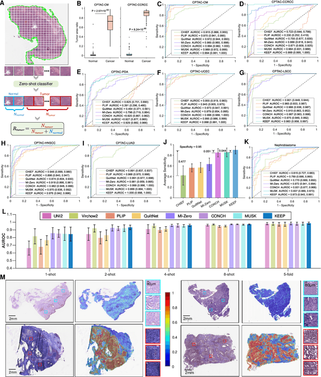 Figure 4 for A Knowledge-enhanced Pathology Vision-language Foundation Model for Cancer Diagnosis