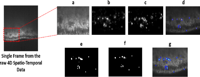 Figure 4 for Automatic Neuronal Activity Segmentation in Fast Four Dimensional Spatio-Temporal Fluorescence Imaging using Bayesian Approach