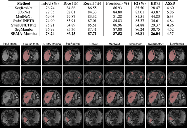 Figure 4 for SRMA-Mamba: Spatial Reverse Mamba Attention Network for Pathological Liver Segmentation in MRI Volumes