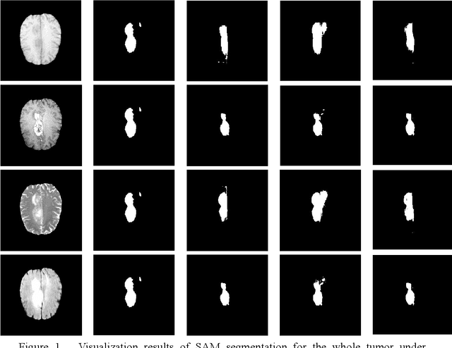 Figure 1 for Segment Anything Model for Brain Tumor Segmentation