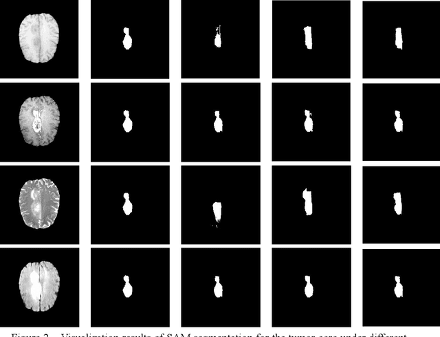 Figure 2 for Segment Anything Model for Brain Tumor Segmentation